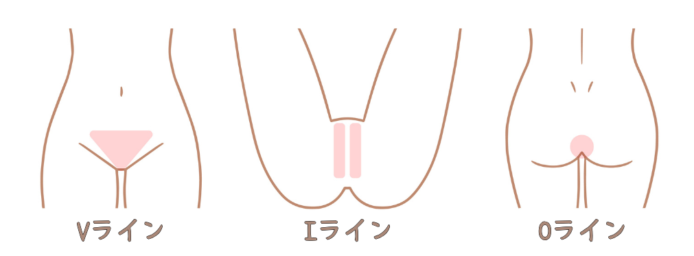 VIOの形・デザイン/イラスト