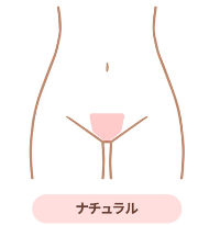 VIOデザイン・ナチュラル（逆三角形）のイラスト